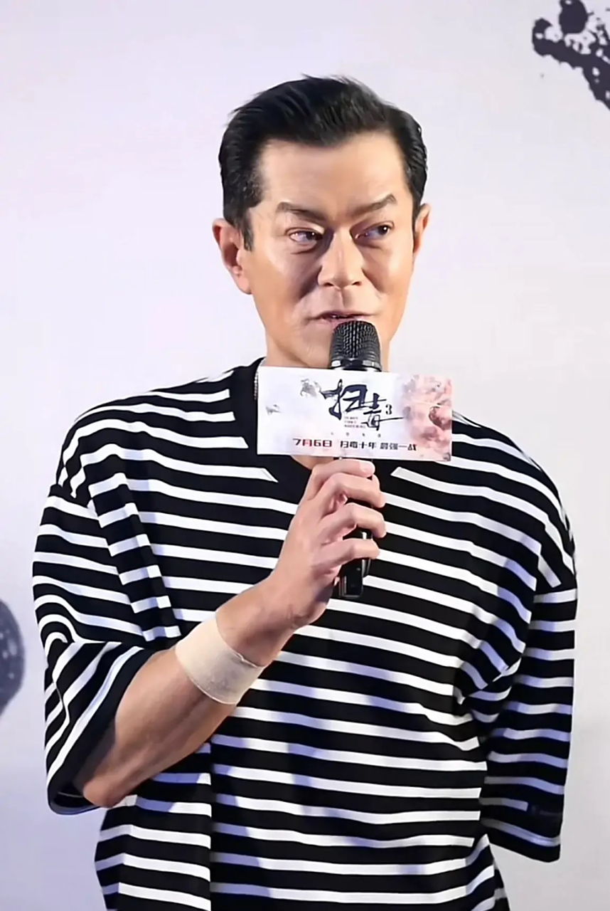 真不敢直视古天乐这双眼睛,太吓人了! 这是做了面部提拉?