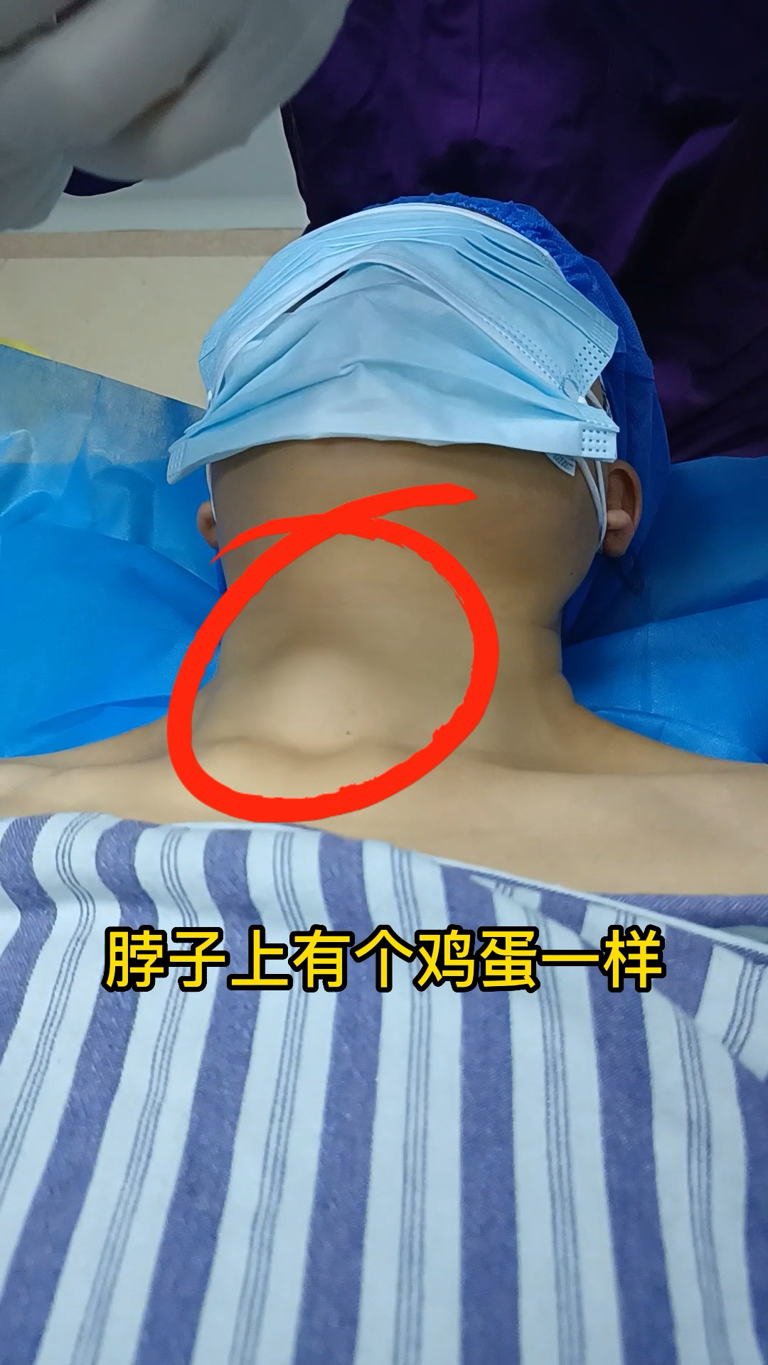 甲状腺囊肿像鸡蛋一样有四公分,拖了这么久才来医院-度小视