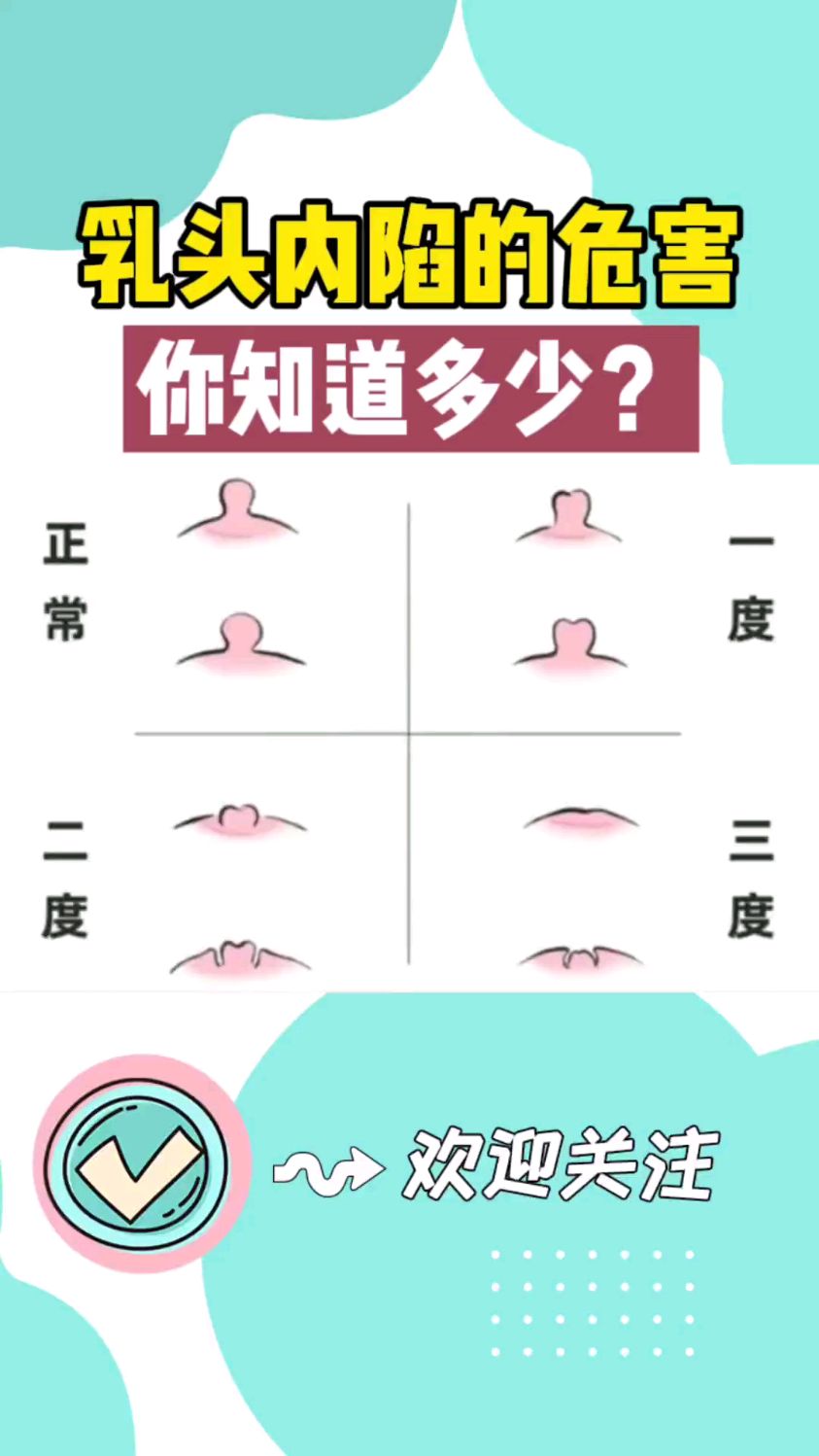 乳头内陷的危害你都知道吗