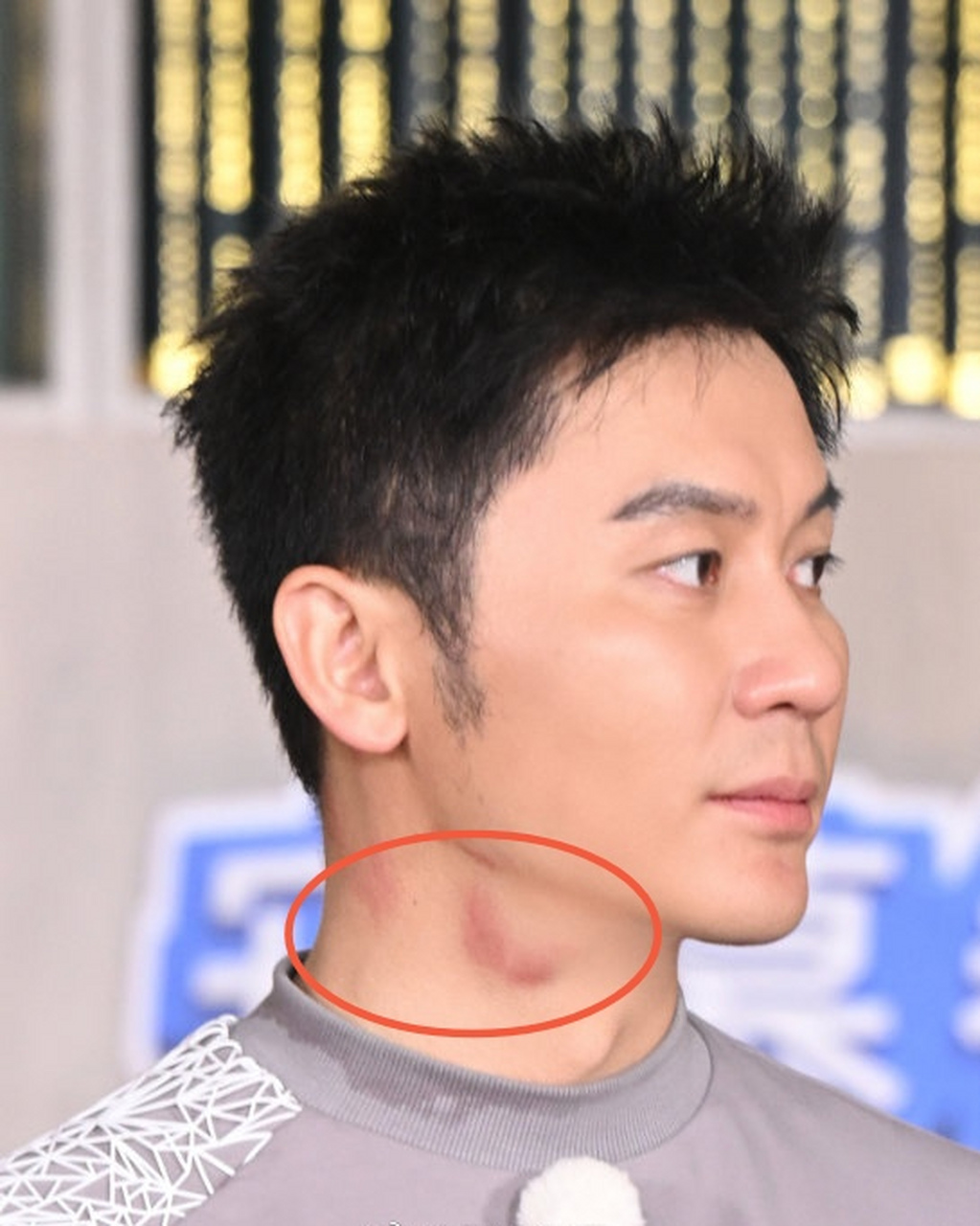 近日,有网友在节目中发现#李晨# 脖子上有红色印记疑似吻痕,引发热议