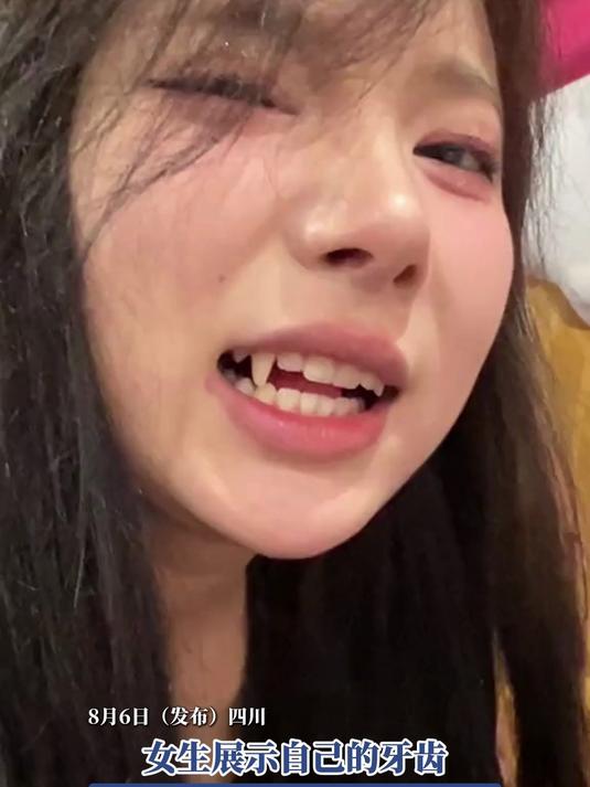 女生展示自己的牙齿,其中一侧的虎牙看着格外长