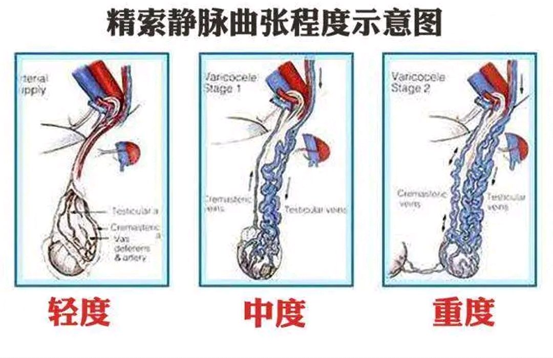 一小伙发现阴囊疼痛