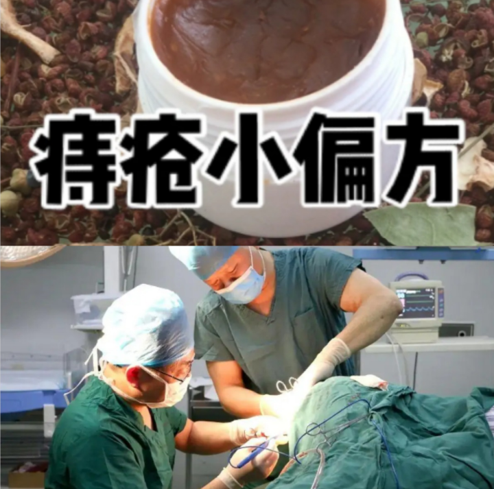 痔瘡过来人分享独家疗法,3周跟顽固肉球说拜拜!