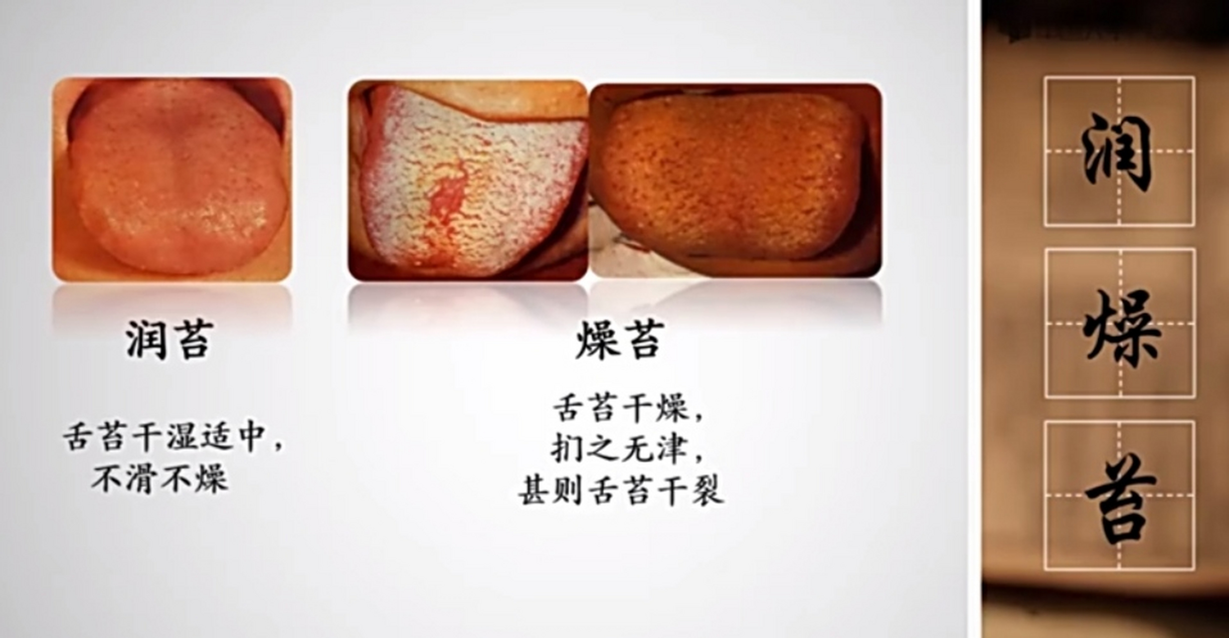 中医"望舌苔"一一润燥苔,腐腻苔的表现,意义