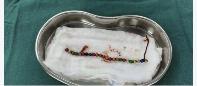 误吞磁力珠多久会有反应_吞了磁力珠会有什么症状 误吞磁力珠多久会有反应_吞了磁力珠会有什么症状（误吞磁力珠对哪里影响最大） 磁力资讯