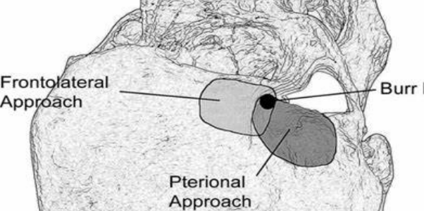 翼点的名词解释