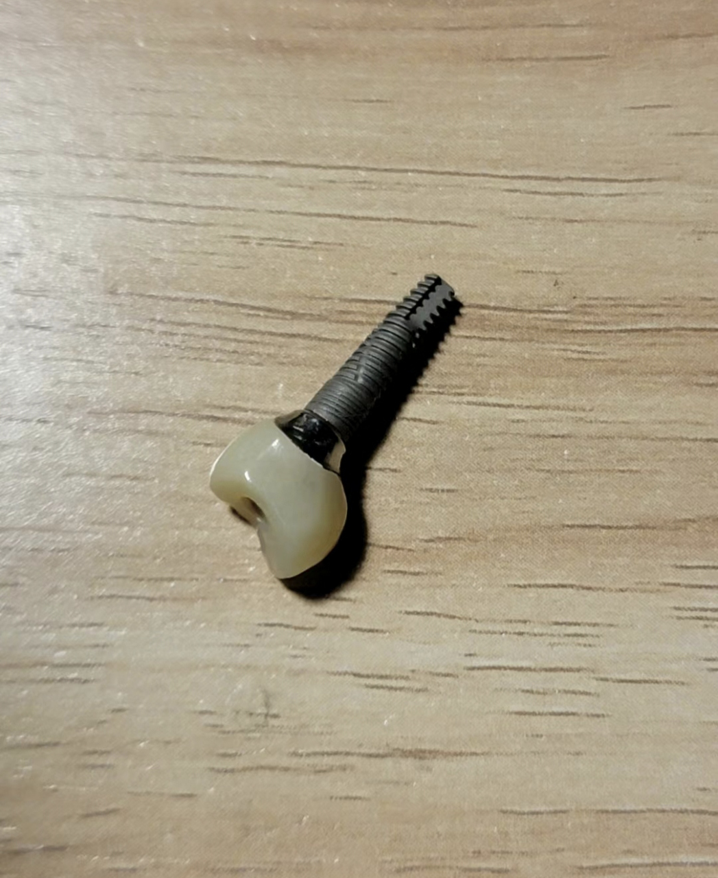 才知道原来种植牙的螺丝这么大个,这扎进去真的不痛吗,想想有点可怕啊