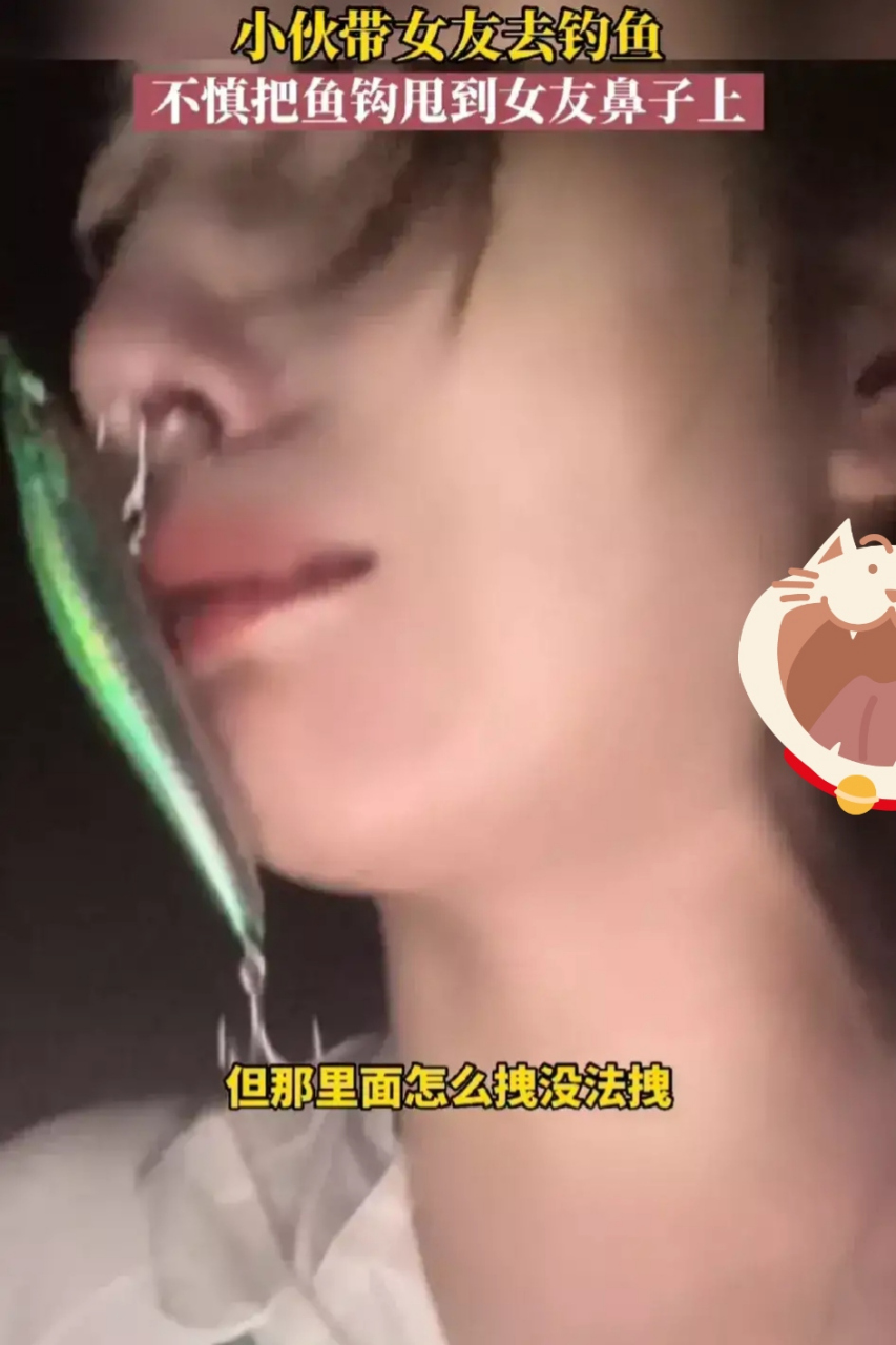 近日,一则关于潍坊男子将鱼钩甩到女友鼻子上成鼻环的新闻引起了广泛