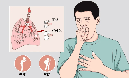 肺纤维化随着病程的进展,会对肺功能产生哪些损伤!