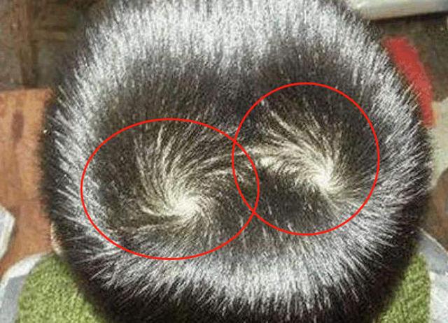 孩子头上的"旋"代表什么?与智商和性格有关吗?今天科普真相