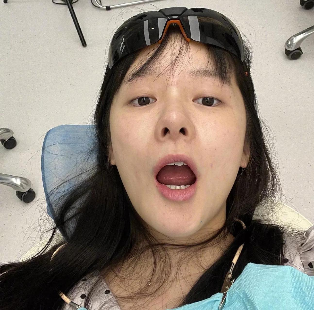 女星徐娇大方晒素颜照!