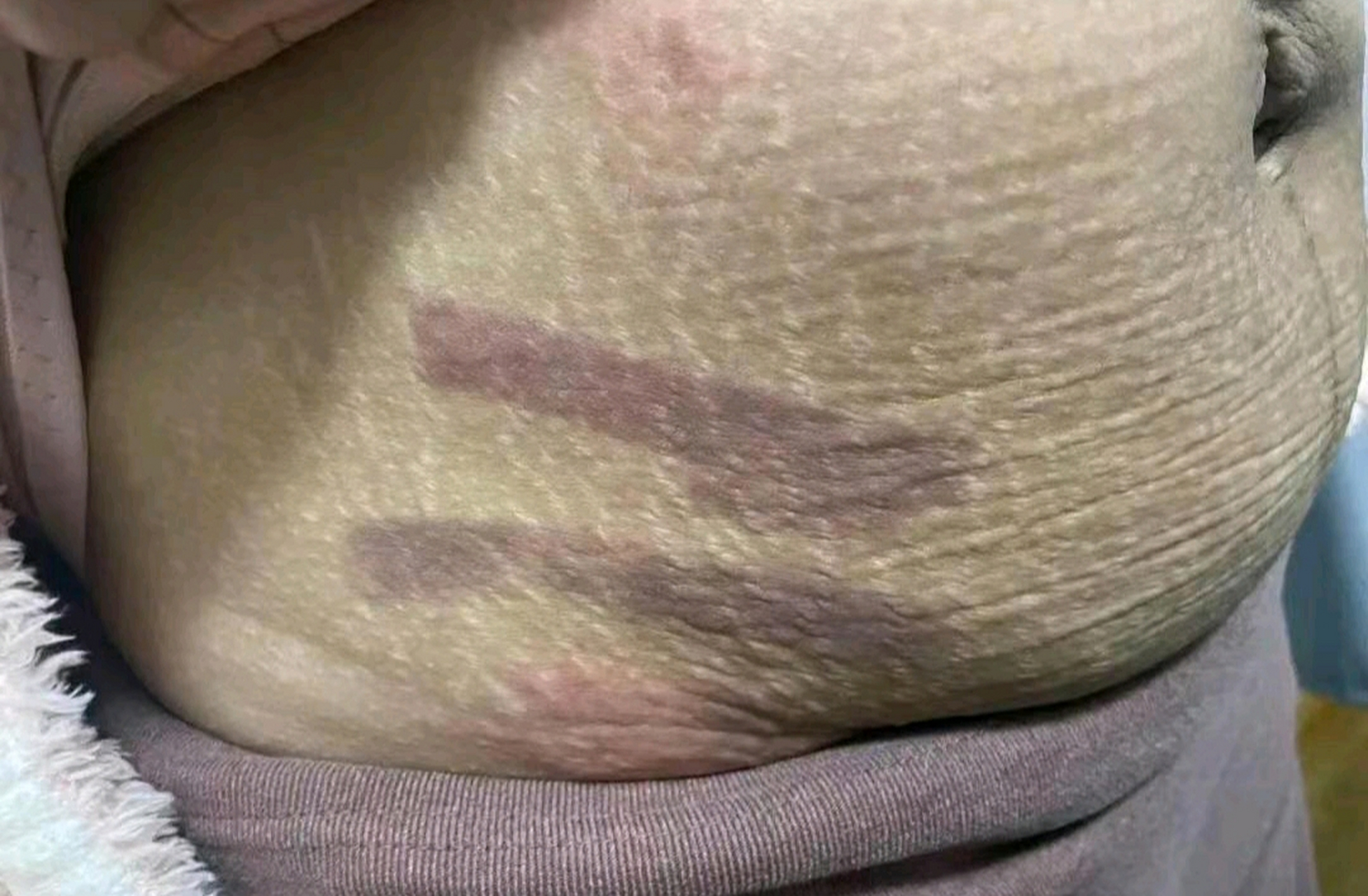 辜负我的女人这辈子是不可能的但是这伤疤是我忘不了的噩梦,好难