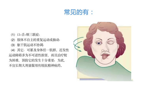 抗精神病药物之"痛",迟发性运动障碍