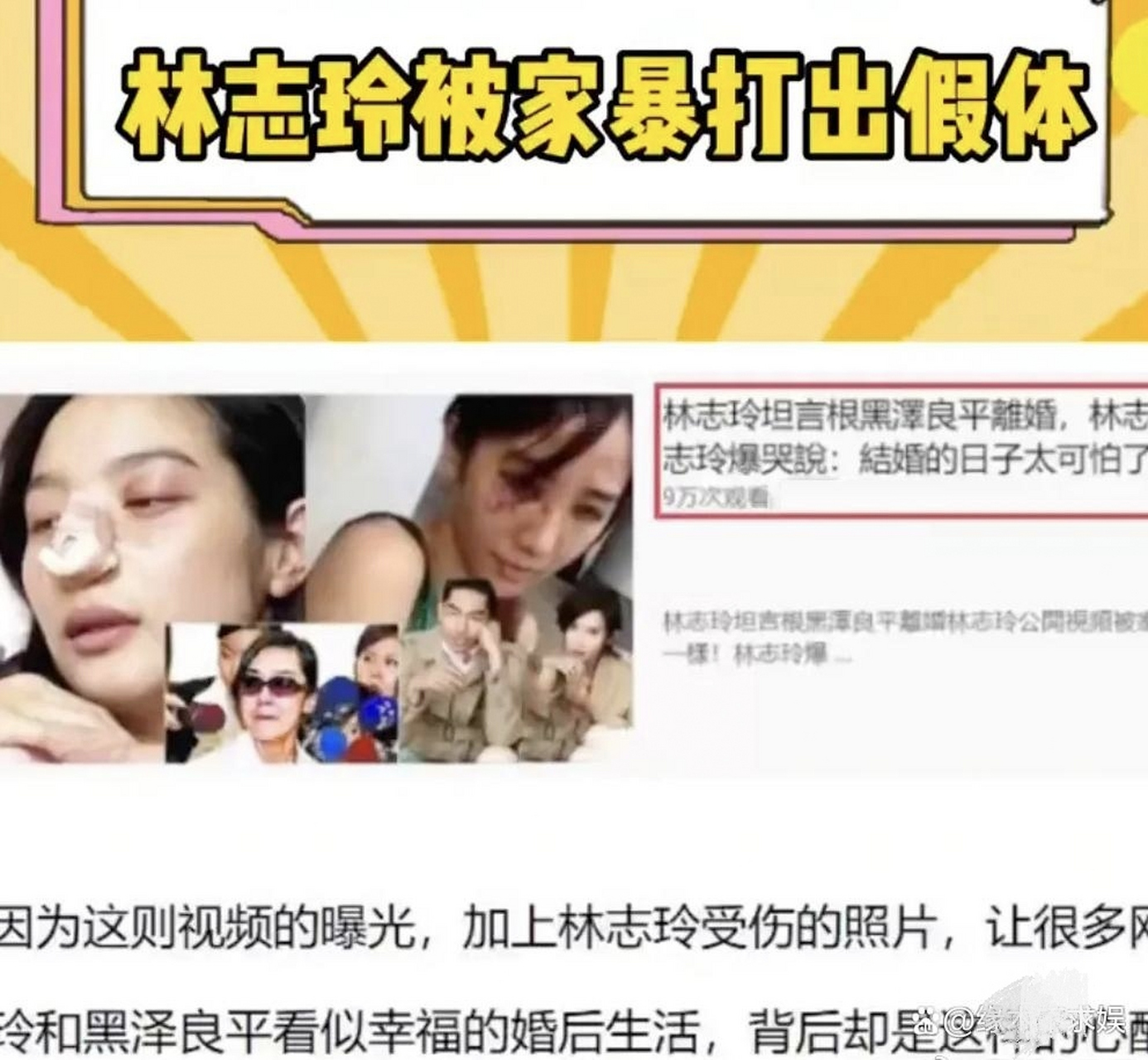 林志玲被老公打事件图片