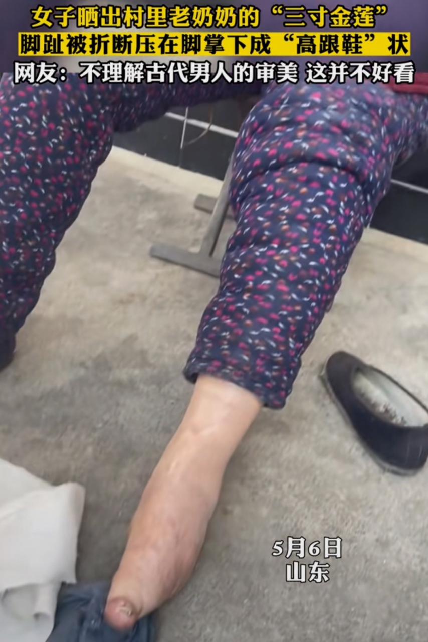女子晒出村里老奶奶的 三寸金莲",脚趾被折断压在
