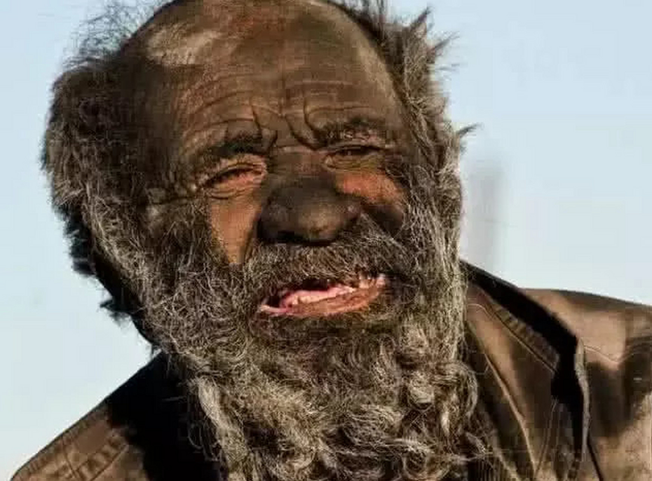 「世界上最脏的人」60年没洗澡洗后病逝!享年94岁