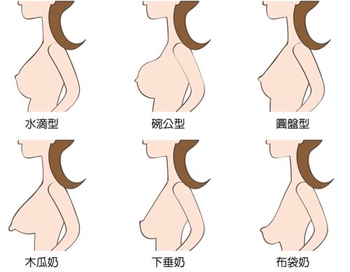 大乳头怎么回事图片