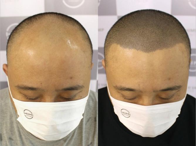 长沙纹发 长沙转折点纹发