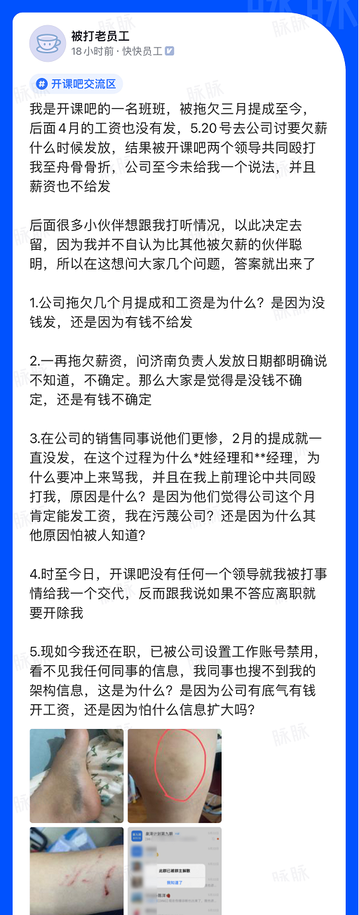 [经验]  拖欠工资不发 员工被打 公司回应称“员工寻衅滋事“