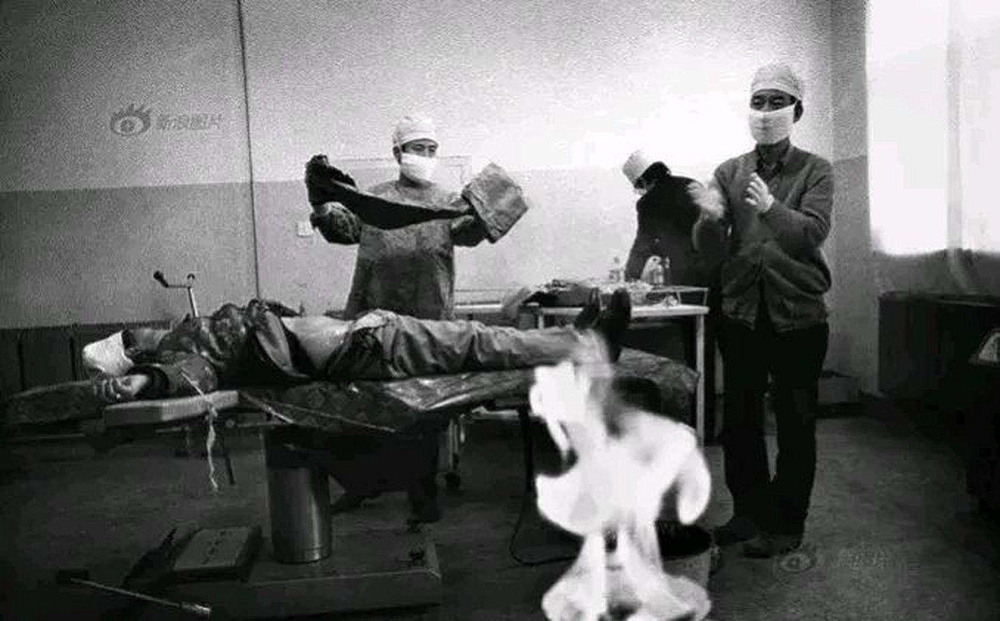 45年前结扎手术照片图片