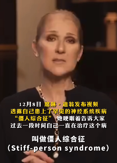 知名女星不幸确诊僵人综合征