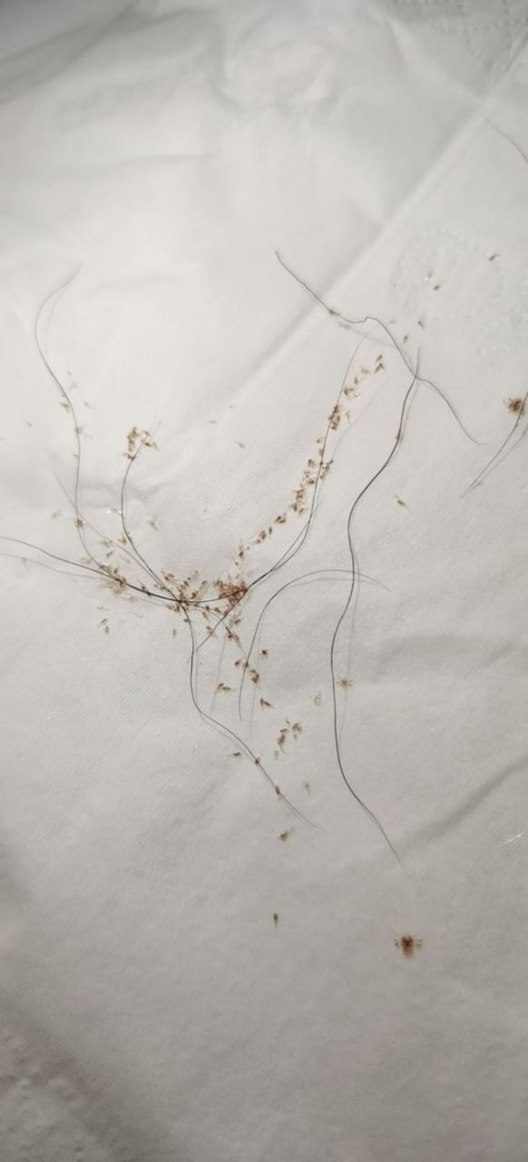 那什么,我帮我朋友问一下,阴虱怎么治疗?头发上面有要剪掉吗?