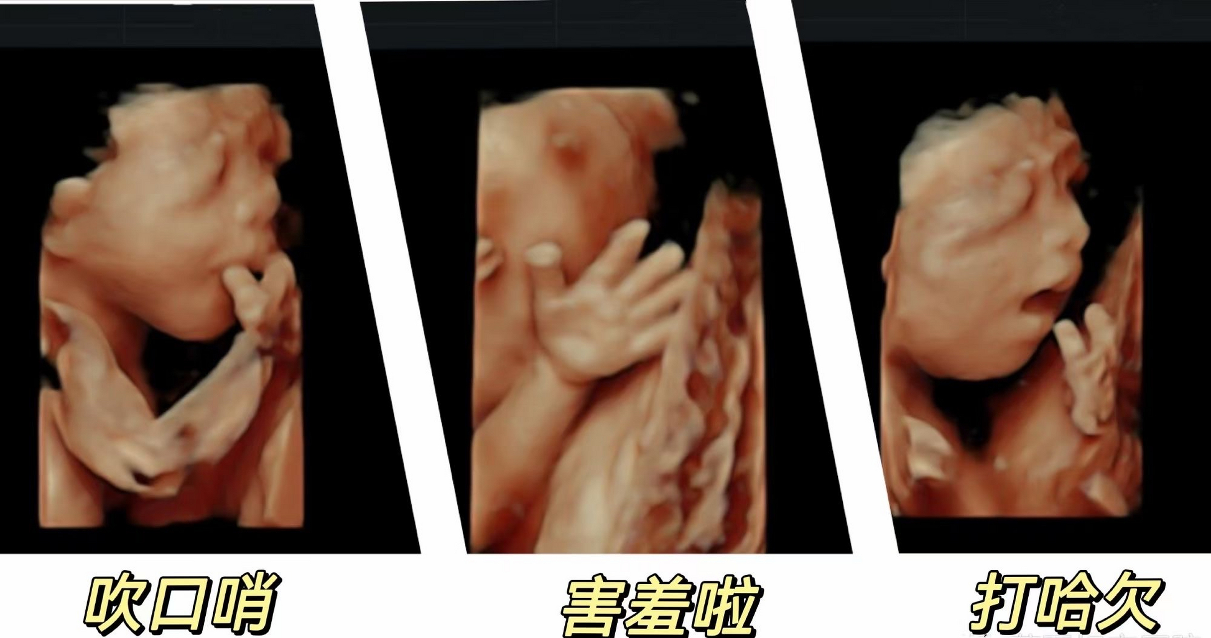 今日份高清四维宝宝  可爱三连拍→吹口哨还害羞!