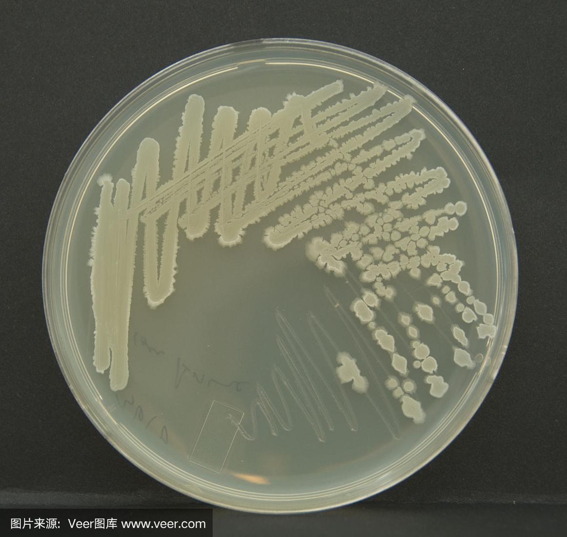 什么是细菌,病毒,真菌?它们都引起哪些感染性疾病?