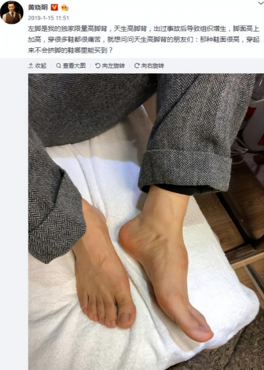 赵丽颖的背,黄晓明的脚,刘亦菲的脖子,打脸了多少"流量明星"