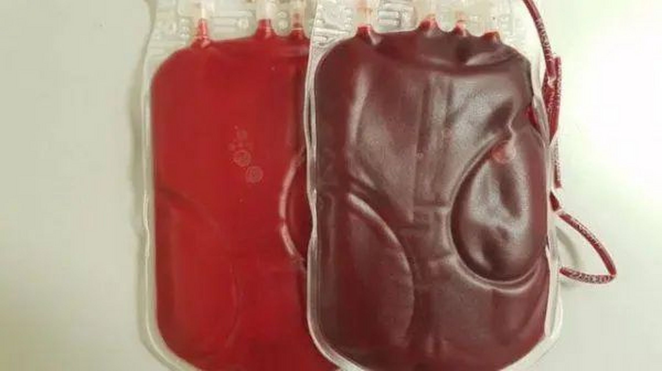 含有较多的氧气,通常是鲜红色,而静脉血是全身组织器官利用完后的血液