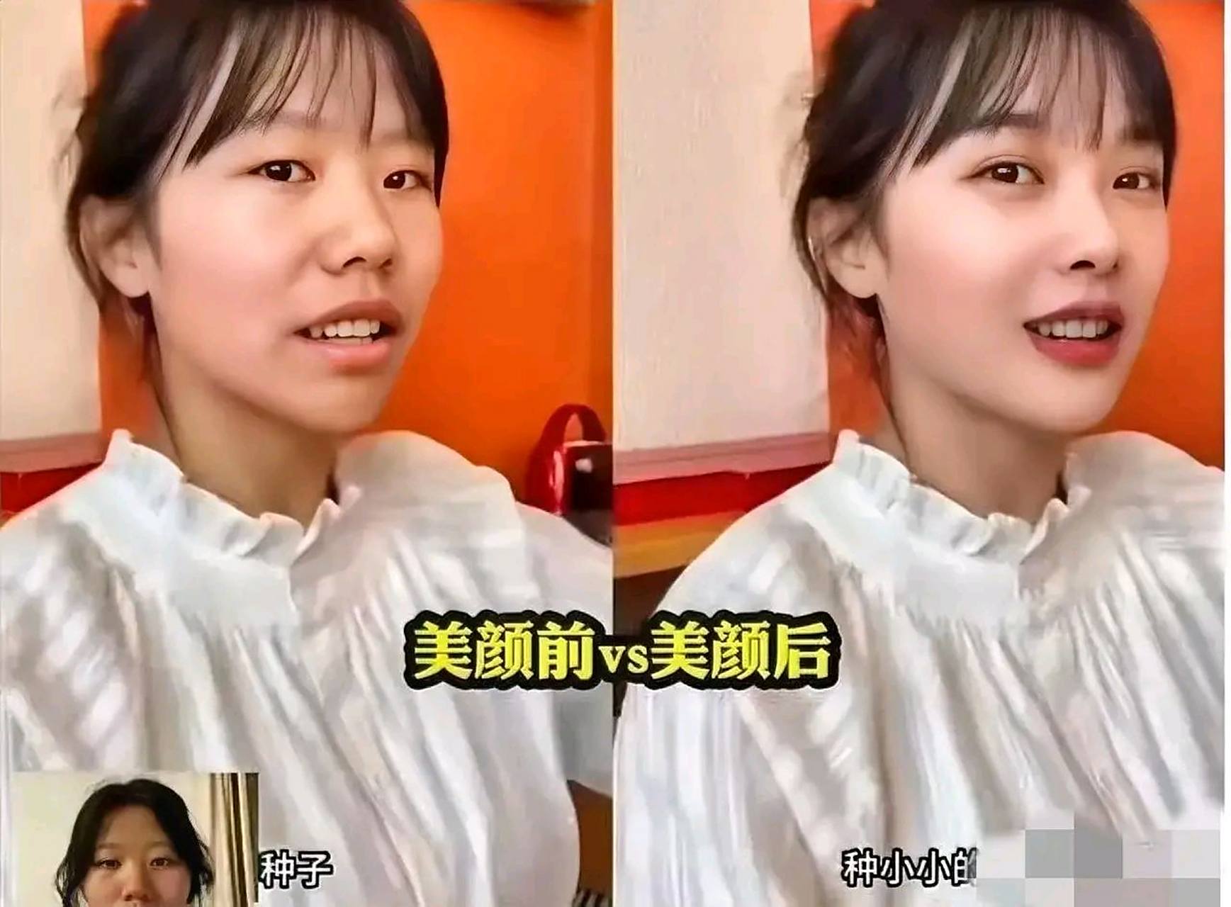 女幼师"挖呀挖"美颜前后对比,真是太普通了!