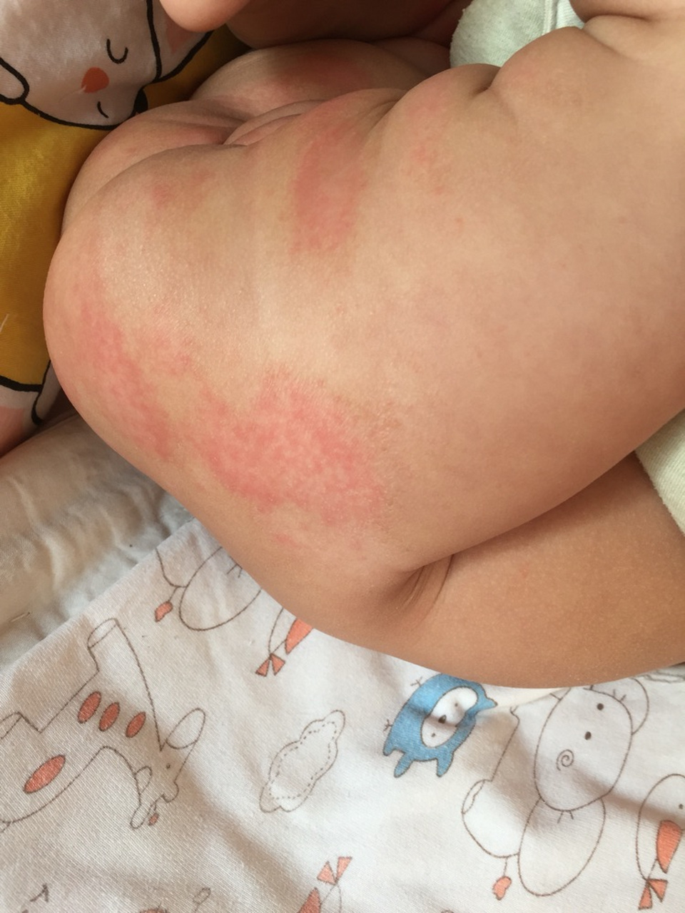 现在给宝宝用的药膏里大都含有激素成分,大家都知道含有激素的用起来