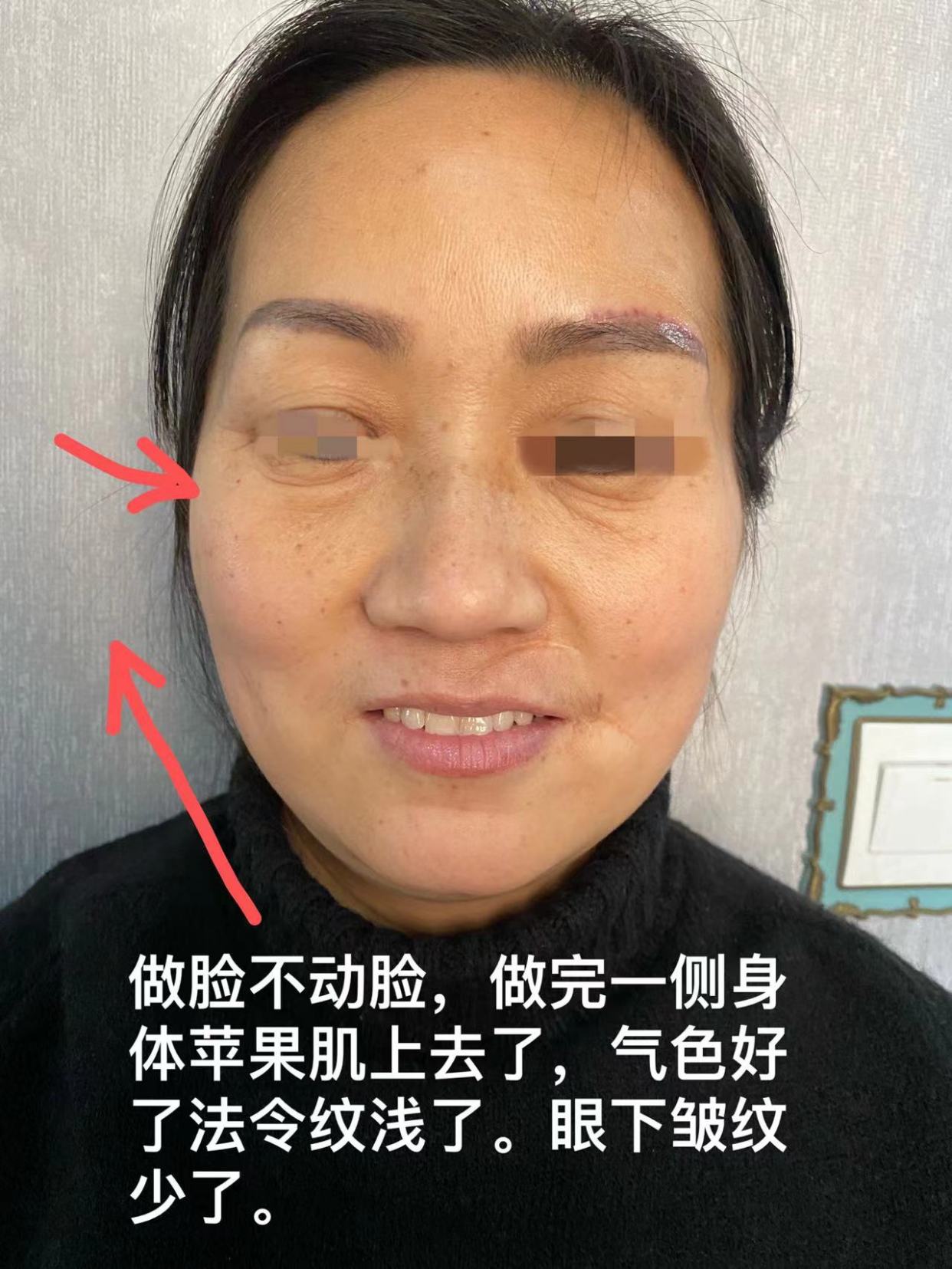 长沙针灸美雕有什么优势天健针灸美雕