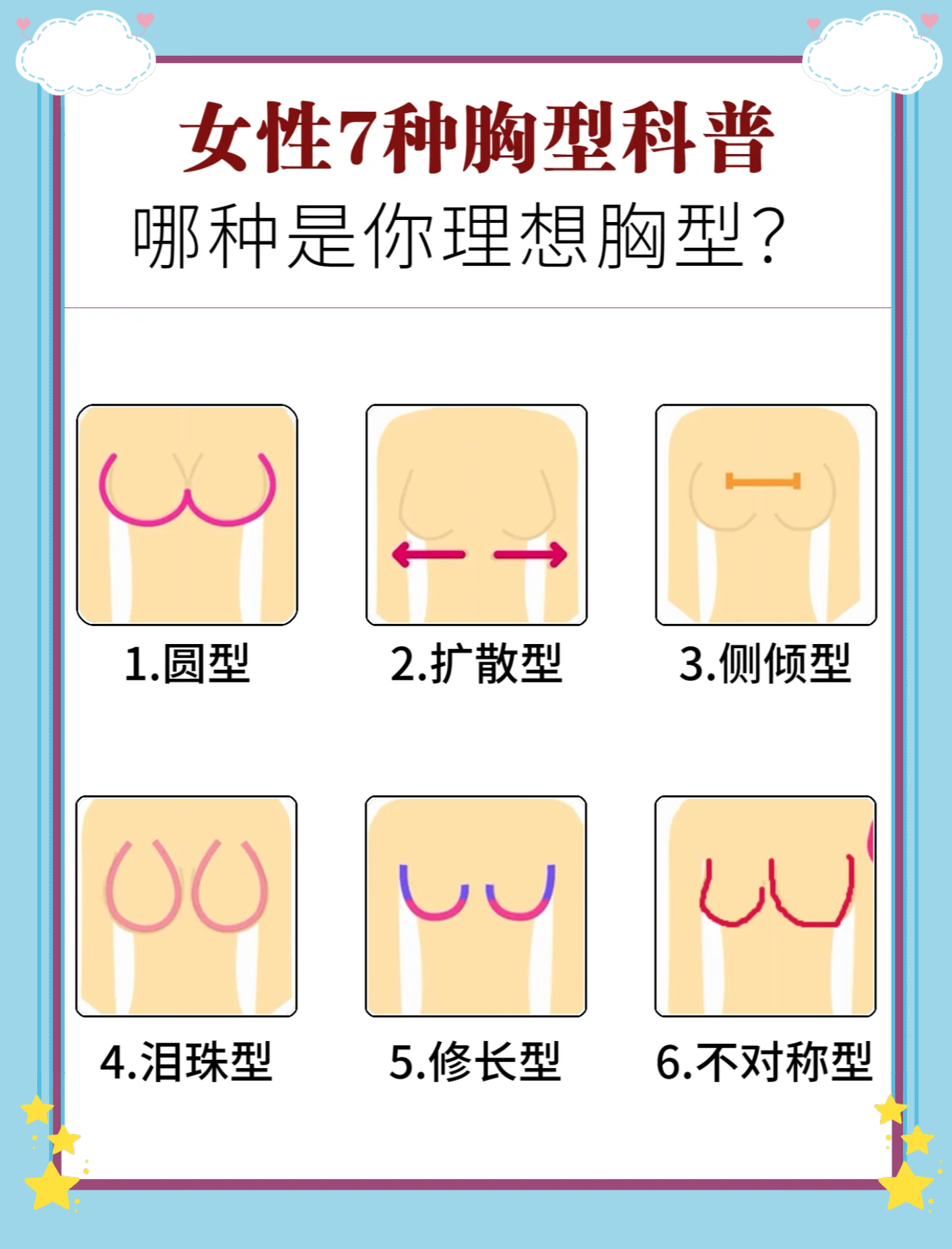 乳房分哪几种图片