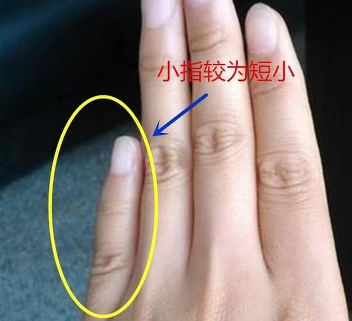 大拇指的第二节出现的橫纹或竖纹称之为财富纹,大姆指第二节与手掌的