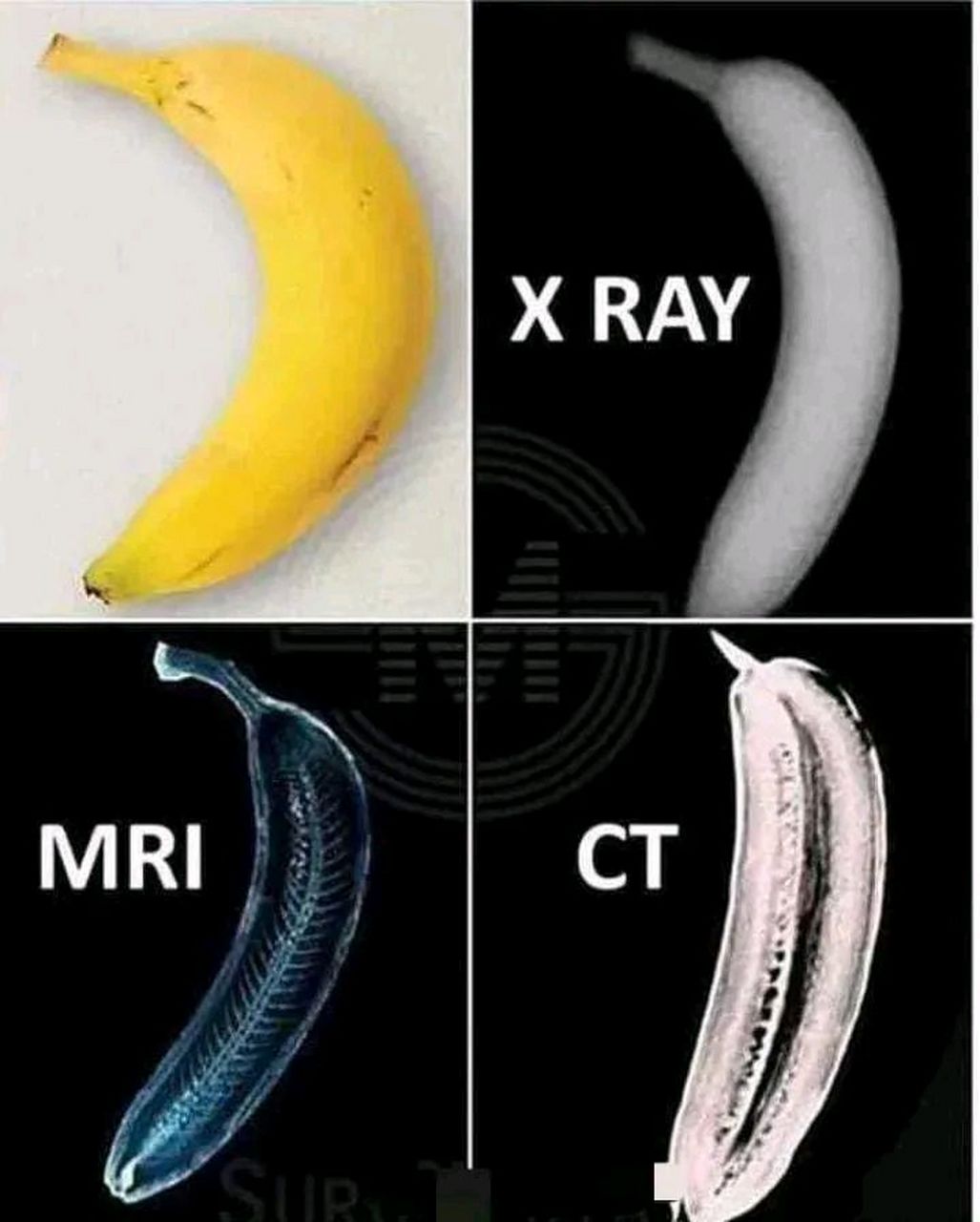 北京口腔医院挂号核磁(MRI)到底有什么区别?的简单介绍