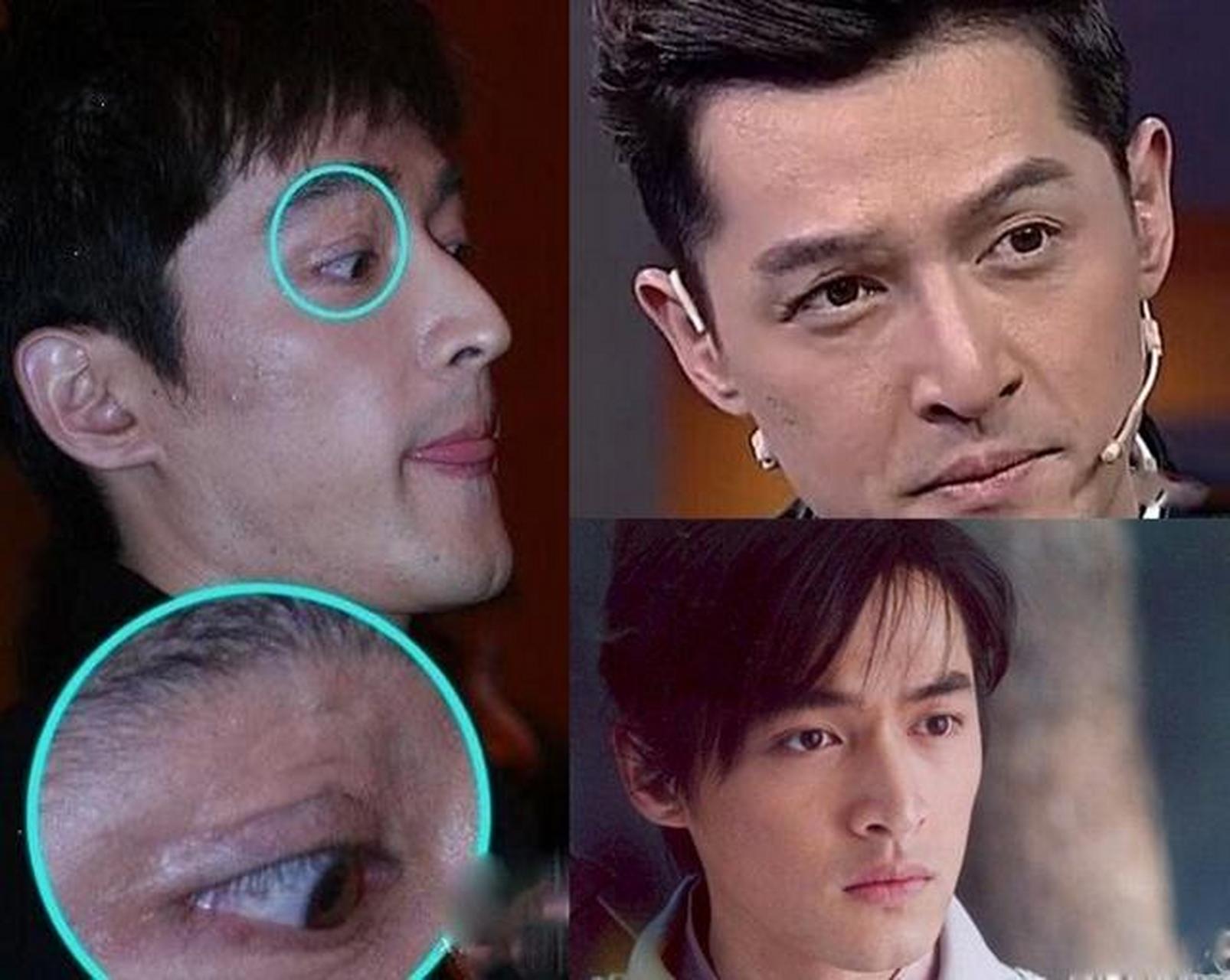 你会觉得胡歌脸上的疤痕是遗憾吗?