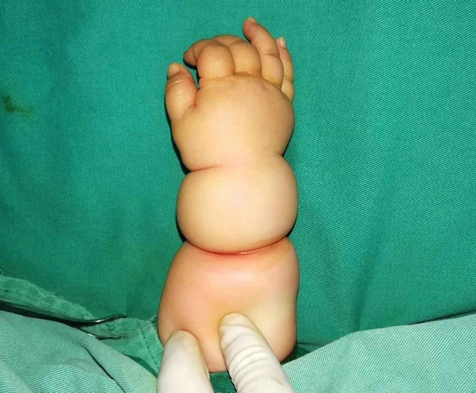 孩子妈妈拽了下,宝宝就哭个不停,怎么哄都哄不好,赶紧抱着孩子去儿童