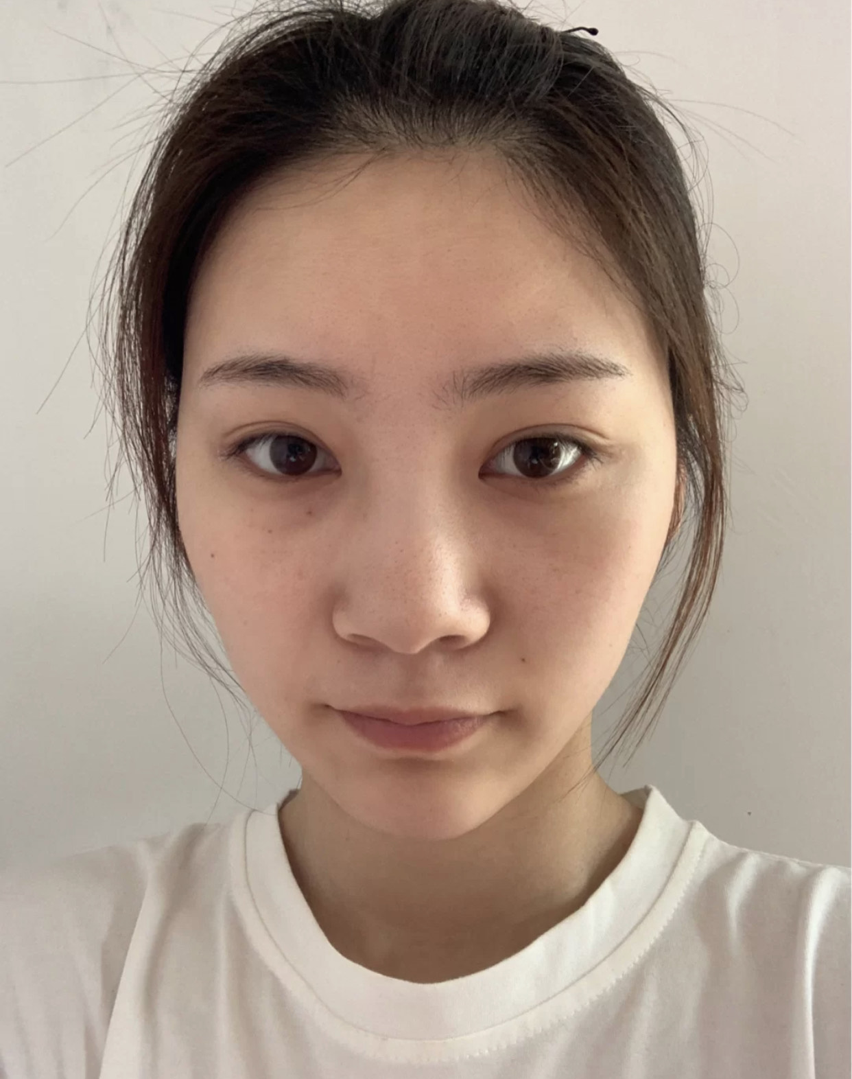 女生常见的"丑鼻型":扁平鼻显胖,蒜头鼻颜值低,塌鼻子影响小