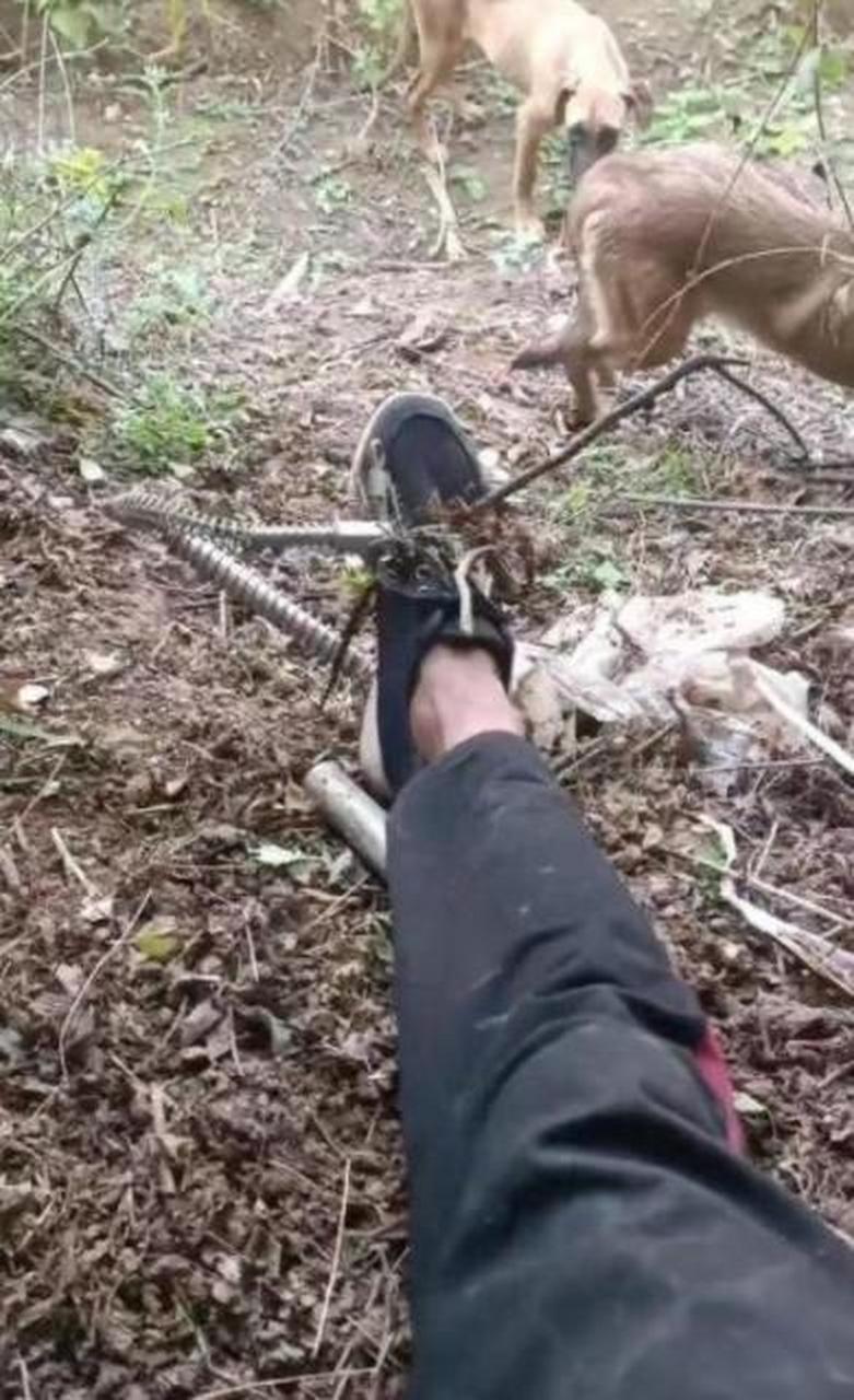 你应该庆幸踩的不是那种带齿的捕兽夹.