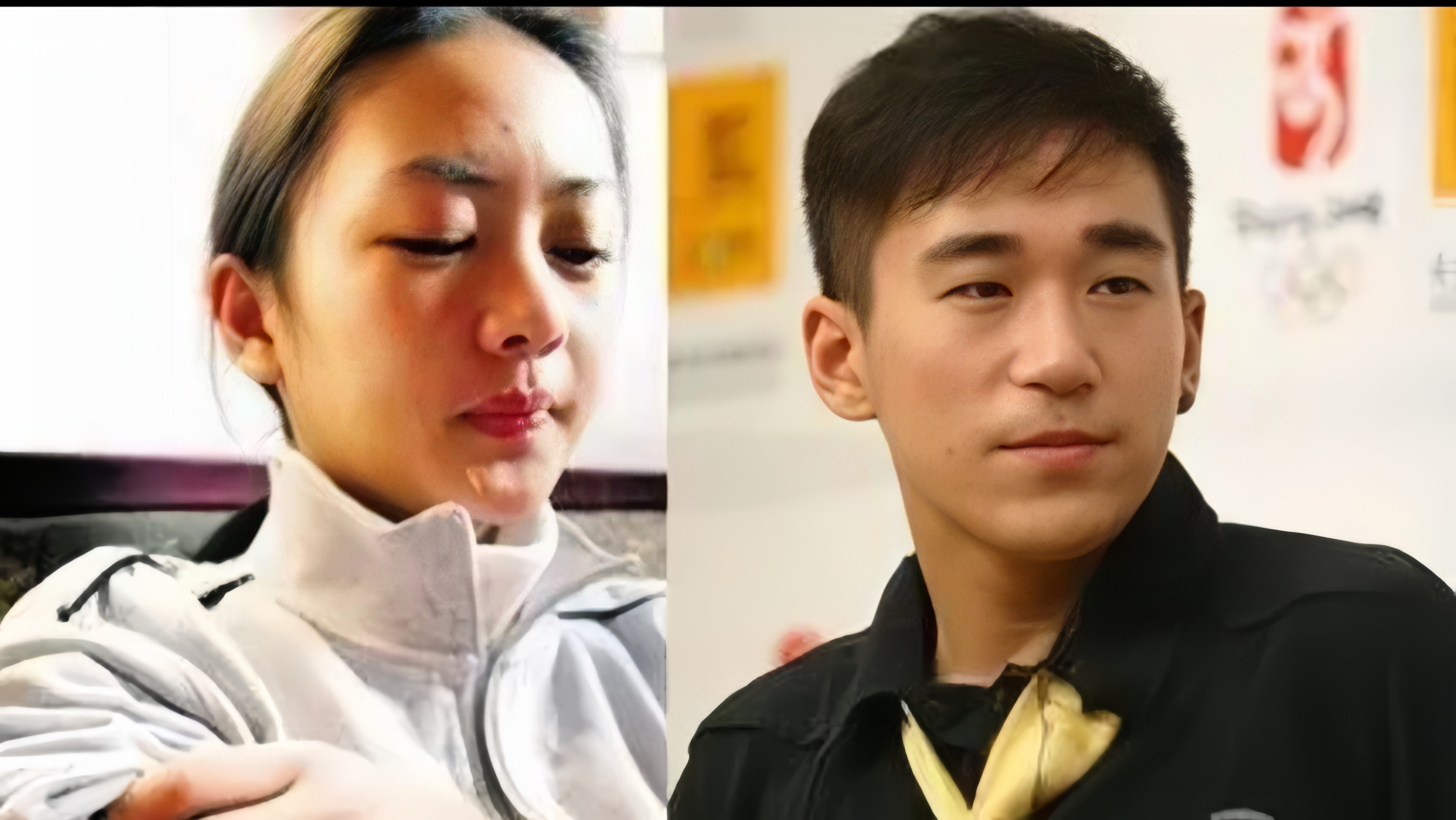 当年,张默对童谣大打出手,导致童谣左眼出血,鼻骨骨折,让人震惊.
