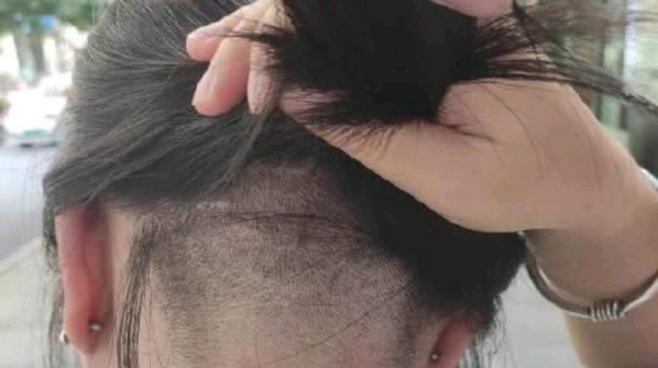 贵州贵阳一女子后脑勺头发被理发师剃掉一半.