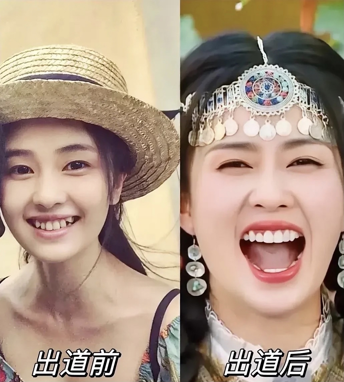 你觉得整牙前后哪个更好看呢?