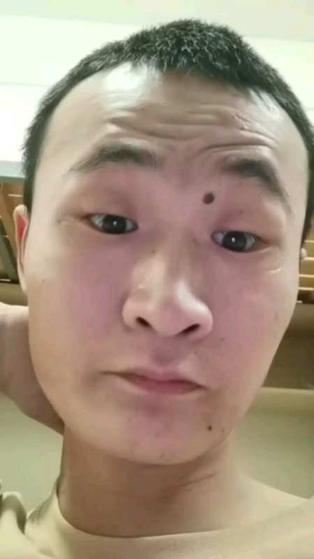 幸运儿面瘫牵正膏好了感谢王博士面瘫牵正膏-度小视