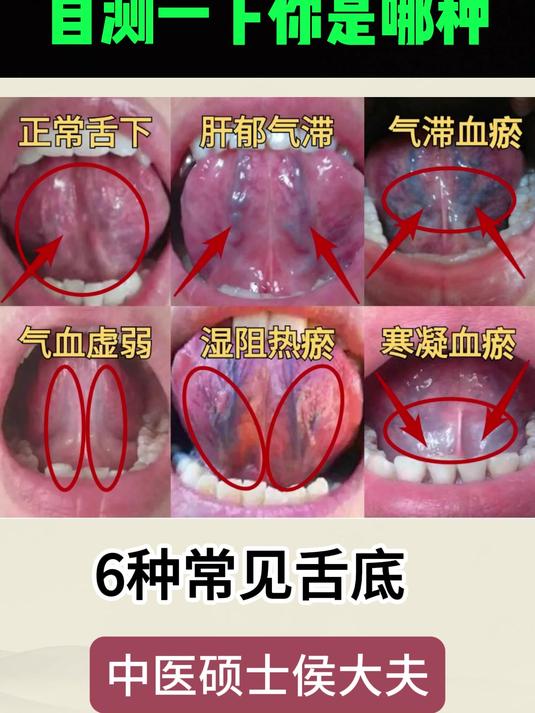 舌下构造图图片