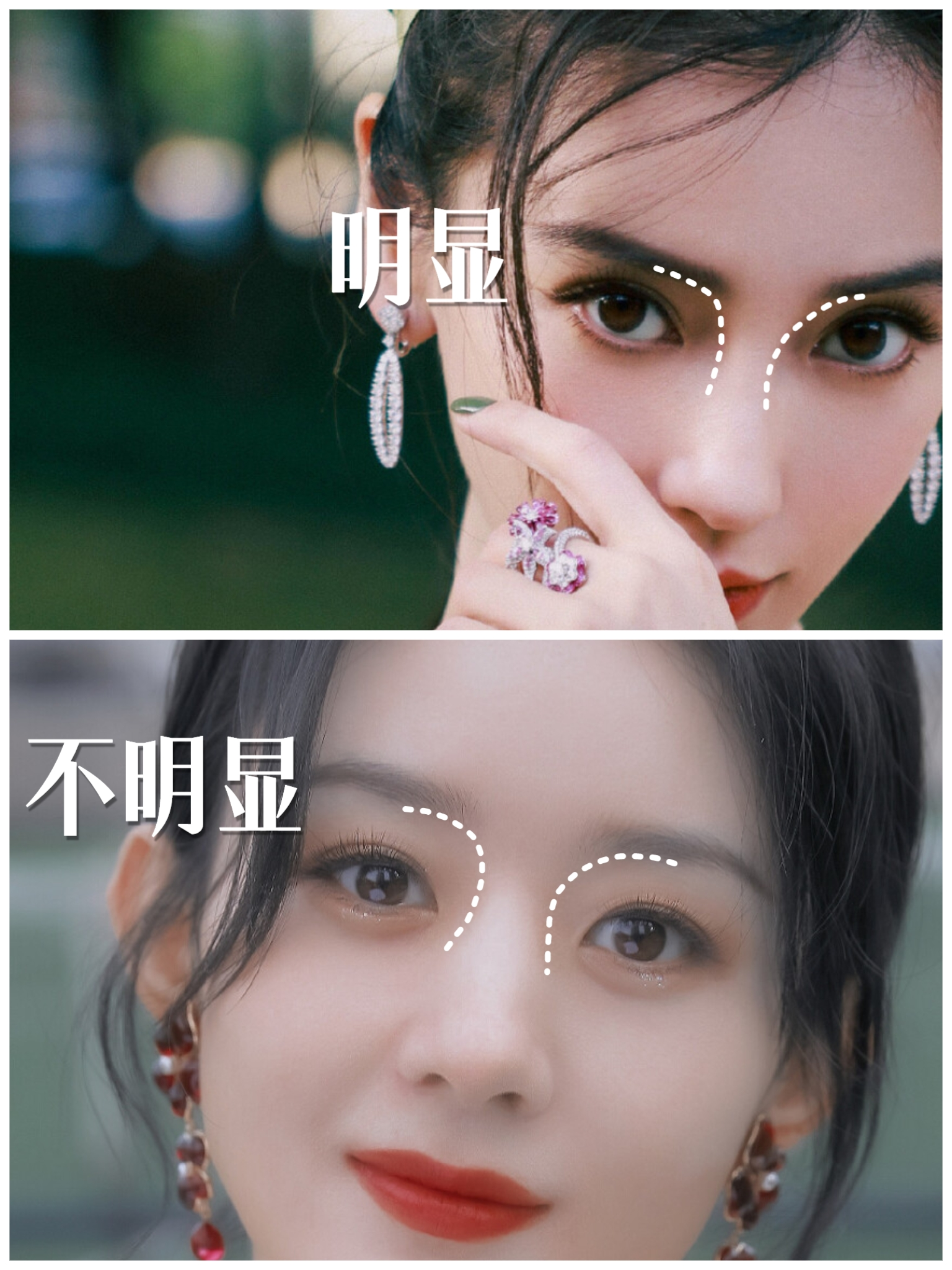 面部的双c线到底是什么?有什么作用?