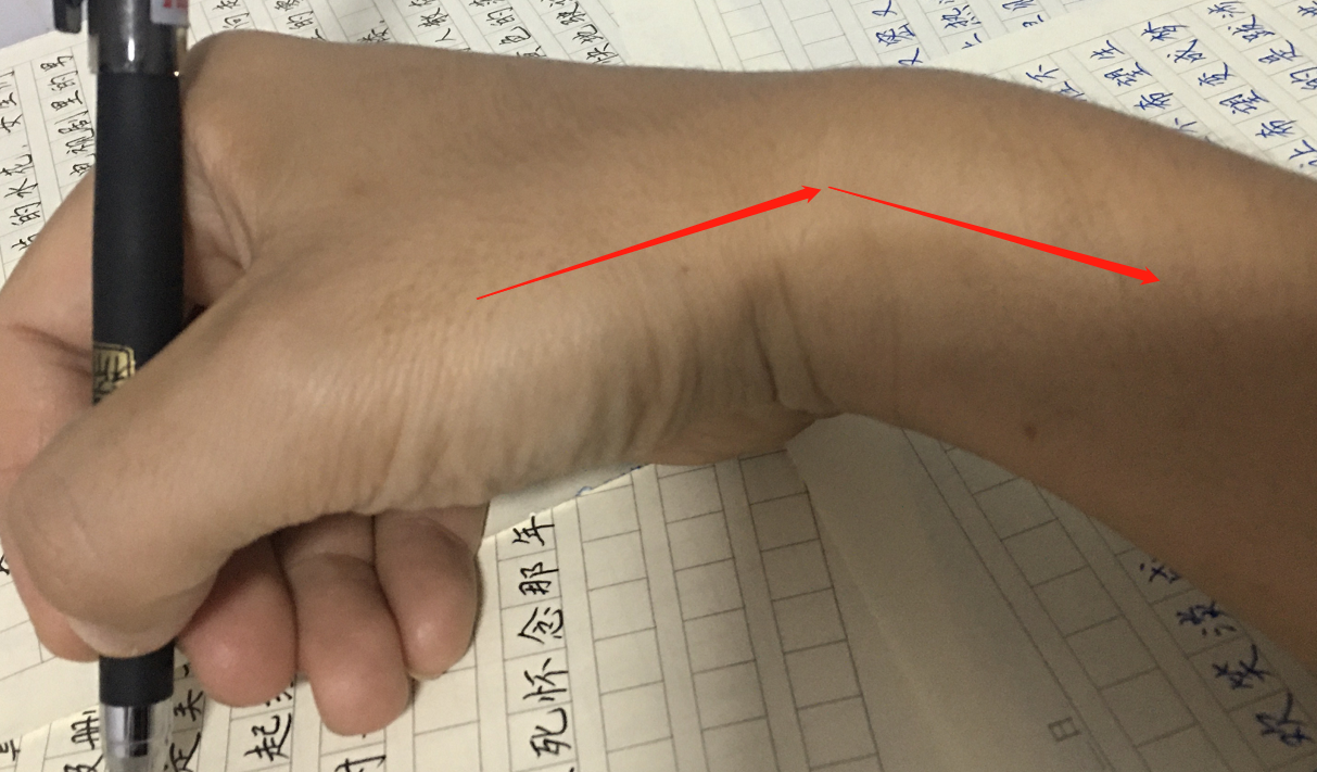 勾腕形成的原因,怎么纠正勾腕的错误姿势