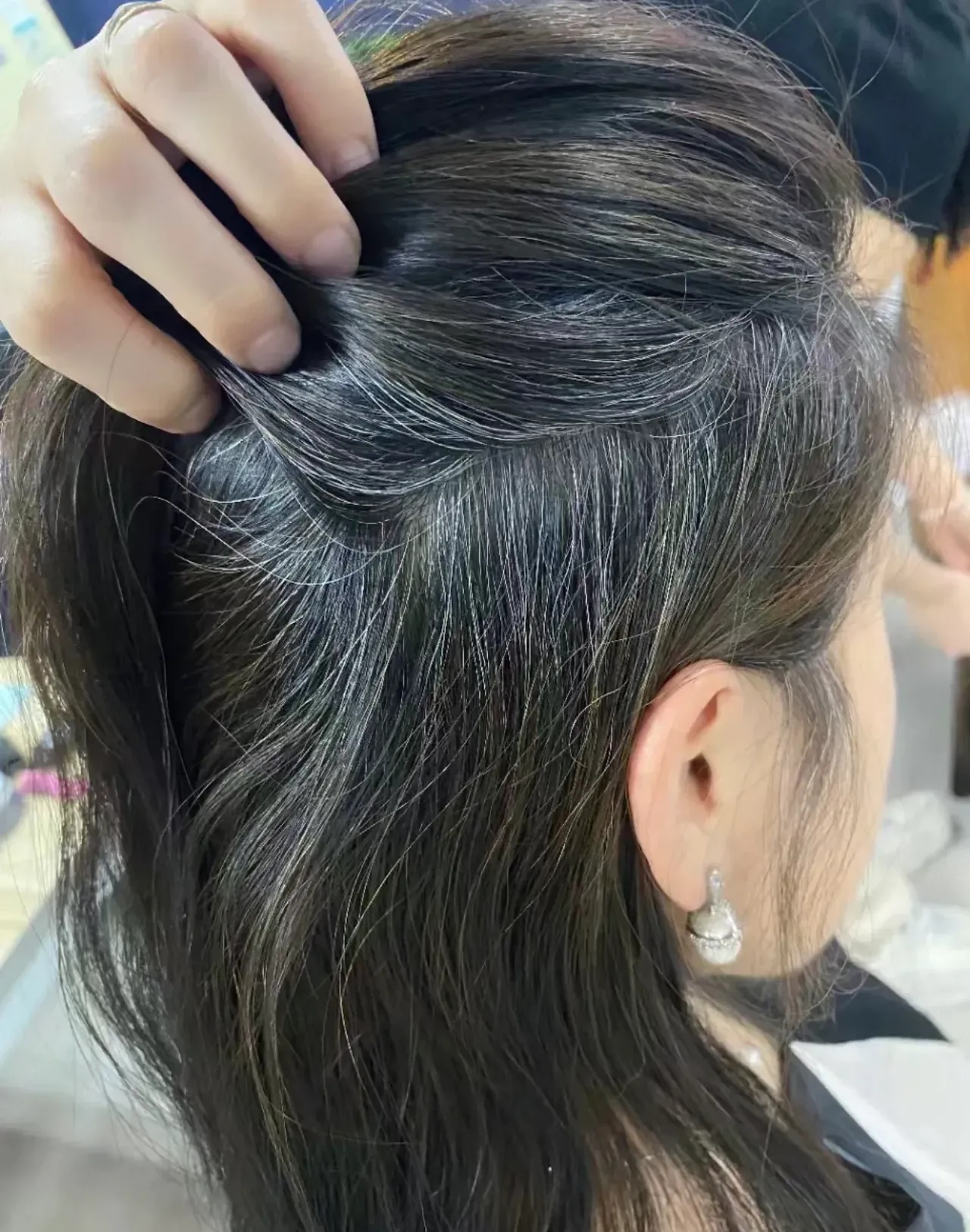 我都快被自己的白头发逼疯了年仅30多岁的我已经被日益增多的白发