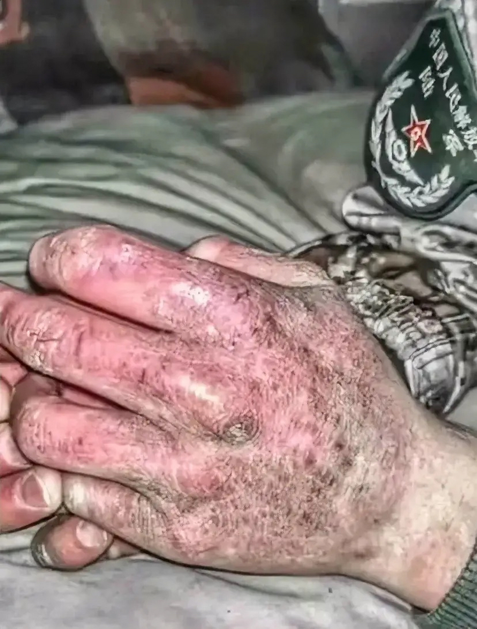 致敬!20岁的兵80岁的手,看着好心痛!