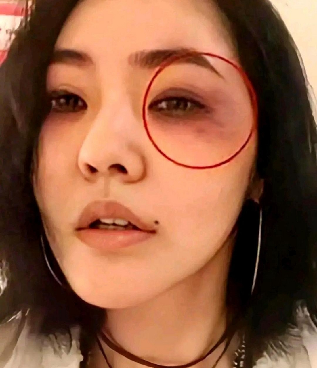 网传小s被打得鼻青脸肿,感觉有点夸张啊,不缺钱不缺名,为什么还要忍呢